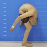 Болезнь Бехтерева: симптомы и лечение