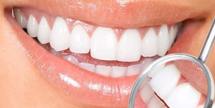 Современные методы отбеливания зубов