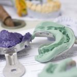 Какой материал для снятия слепков зубов выбрать