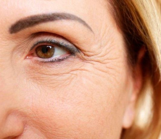 Морщины на лице: причины появления и методы устранения