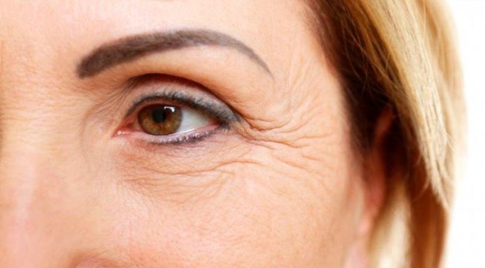 Морщины на лице: причины появления и методы устранения