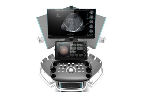 УЗИ аппарат Mindray Consona N9 и его возможности