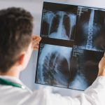 Рентген-диагностика: взгляд внутрь