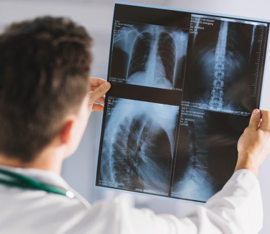 Рентген-диагностика: взгляд внутрь