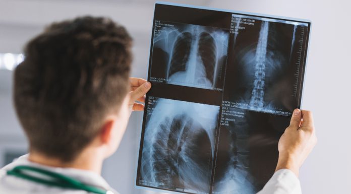 Рентген-диагностика: взгляд внутрь