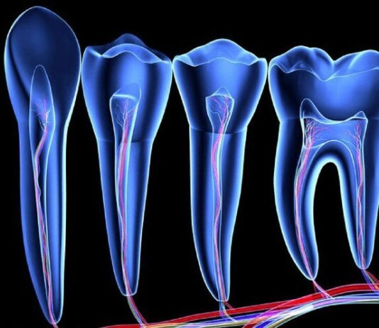 Что входит в эндодонтическое лечение