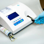 Мочевые анализаторы: назначение и виды