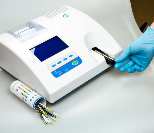 Мочевые анализаторы: назначение и виды