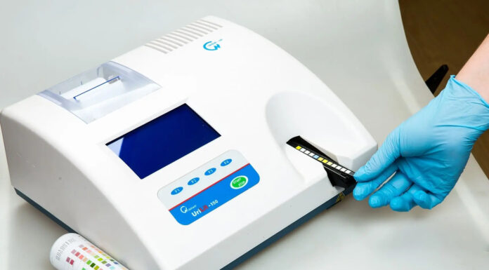 Мочевые анализаторы: назначение и виды