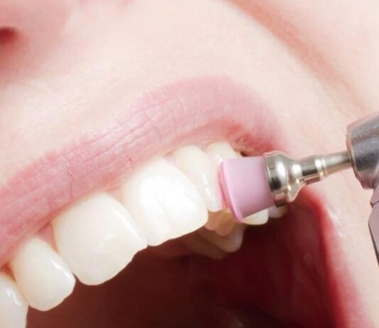 Чистка зубов: как проводится эта процедура?