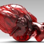 Гипертрофия миокарда: причины, симптомы и лечение