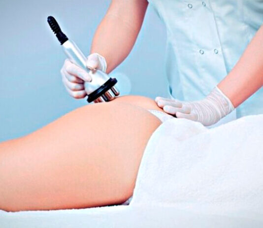 Особенности процедуры радиолифтинга бедер и ягодиц