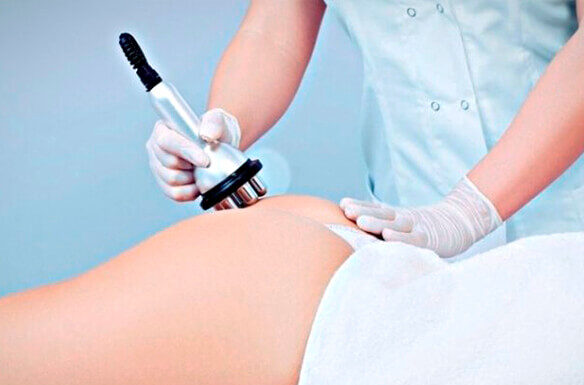 Особенности процедуры радиолифтинга бедер и ягодиц