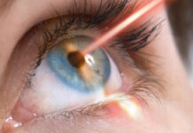 Основные методы лазерной коррекции зрения