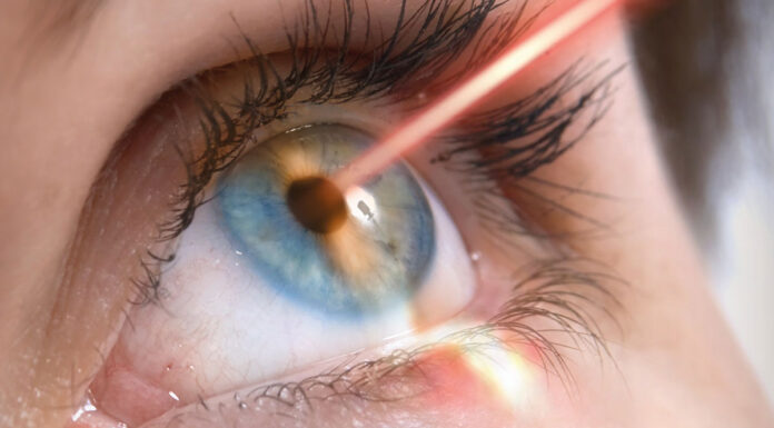 Основные методы лазерной коррекции зрения