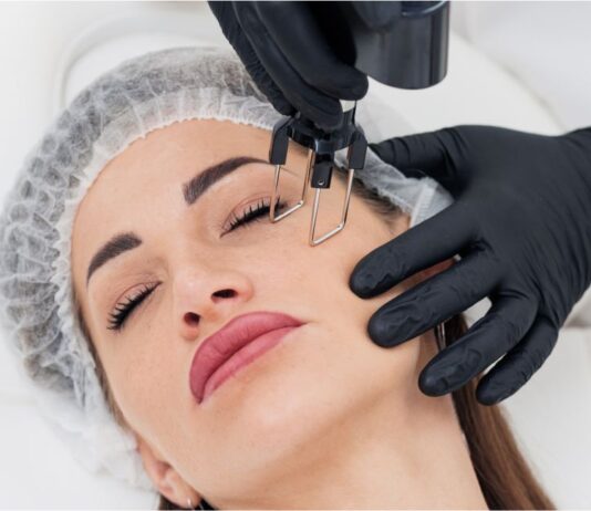 Преимущества лазерной шлифовки