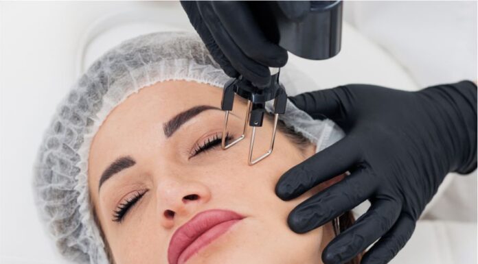 Преимущества лазерной шлифовки