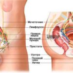 Рак предстательной железы: основные аспекты