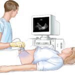 Зачем надо делать УЗИ брюшной полости?