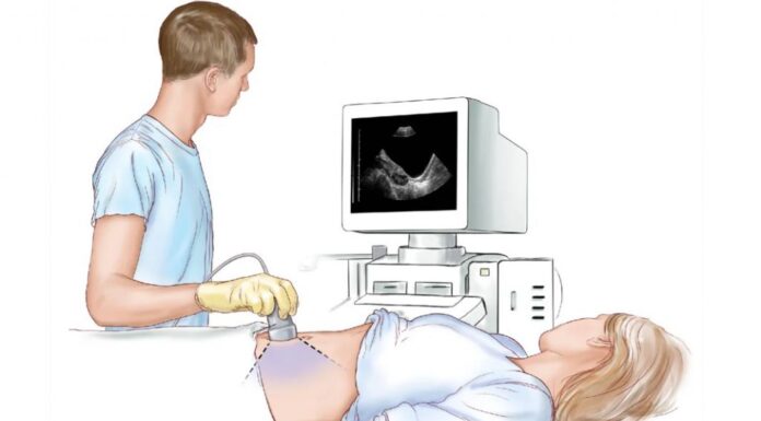 Зачем надо делать УЗИ брюшной полости?