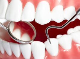 Лечение кариеса: как вовремя распознать проблему и избежать осложнений