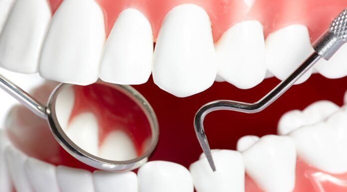 Лечение кариеса: как вовремя распознать проблему и избежать осложнений