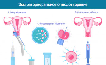 Кому показана процедура ЭКО?