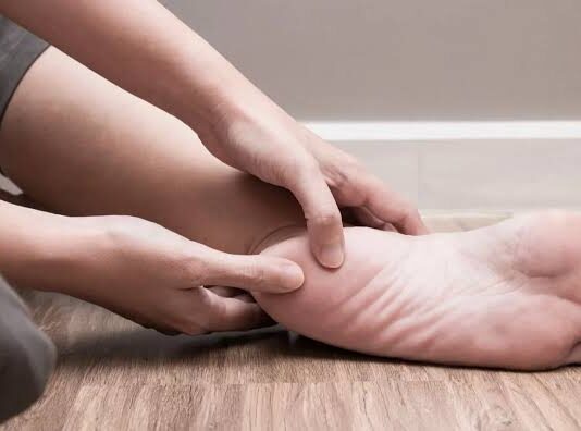 Почему возникает бурсит пятки?