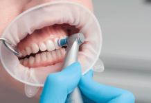 Профессиональная гигиена полости рта: особенности проведения и преимущества