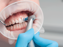 Профессиональная гигиена полости рта: особенности проведения и преимущества