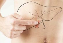 Болезни желчного пузыря