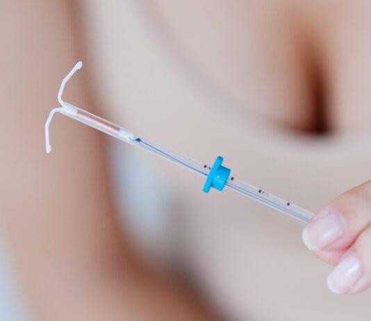 Что такое Спираль Мирена?