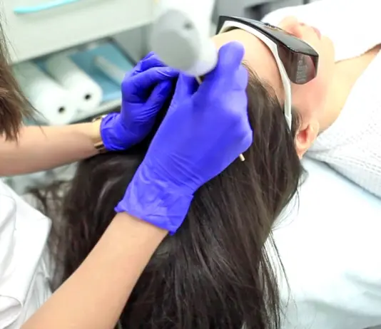 Лазерная терапия кожи головы Fotona: преимущества и особенности