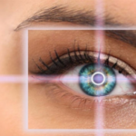 Рефракционная замена хрусталика