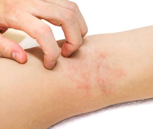 Дерматит: виды, причины и способы лечения