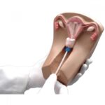 Мифы и правда о восстановлении девственной плевы