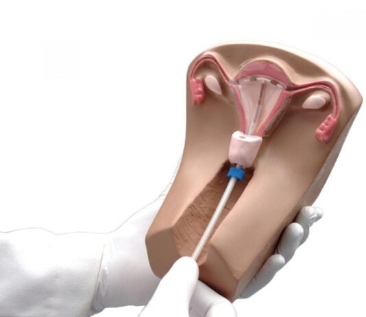 Мифы и правда о восстановлении девственной плевы