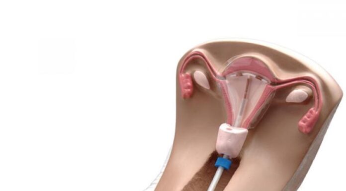 Мифы и правда о восстановлении девственной плевы